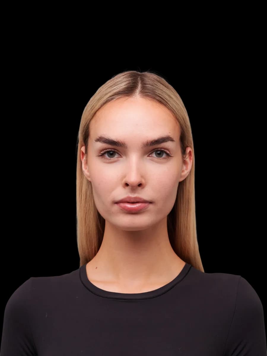 Skin & midface, after